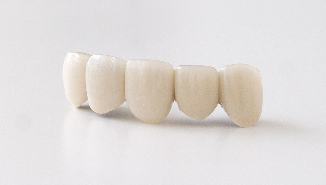 堺市中区・深井駅のセラミック治療