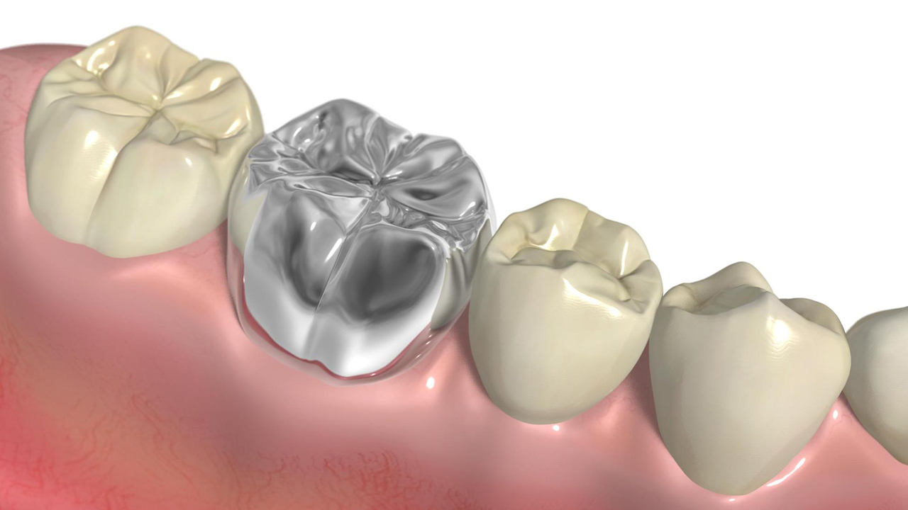 堺市中区・深井駅の金属アレルギー