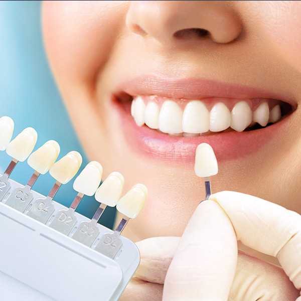 堺市中区・深井駅の審美歯科