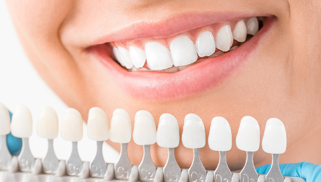 堺市中区・深井駅のセラミック治療