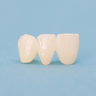 メタルフリー治療 - あづみ歯科クリニック（堺市中区・深井駅）